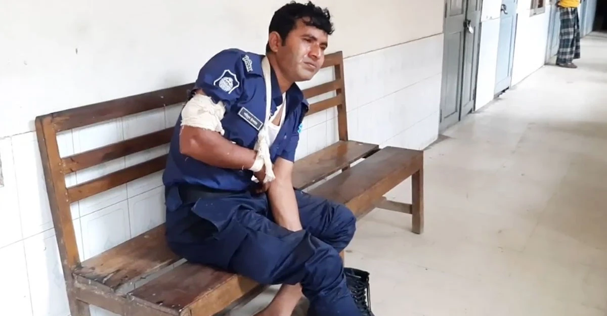 মাদক মামলার আসামি ধরতে গিয়ে হামলার শিকার পুলিশ।ছবি:সংগৃহীত